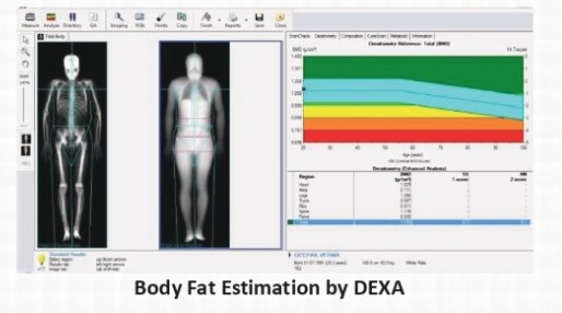DEXA Scan Machine